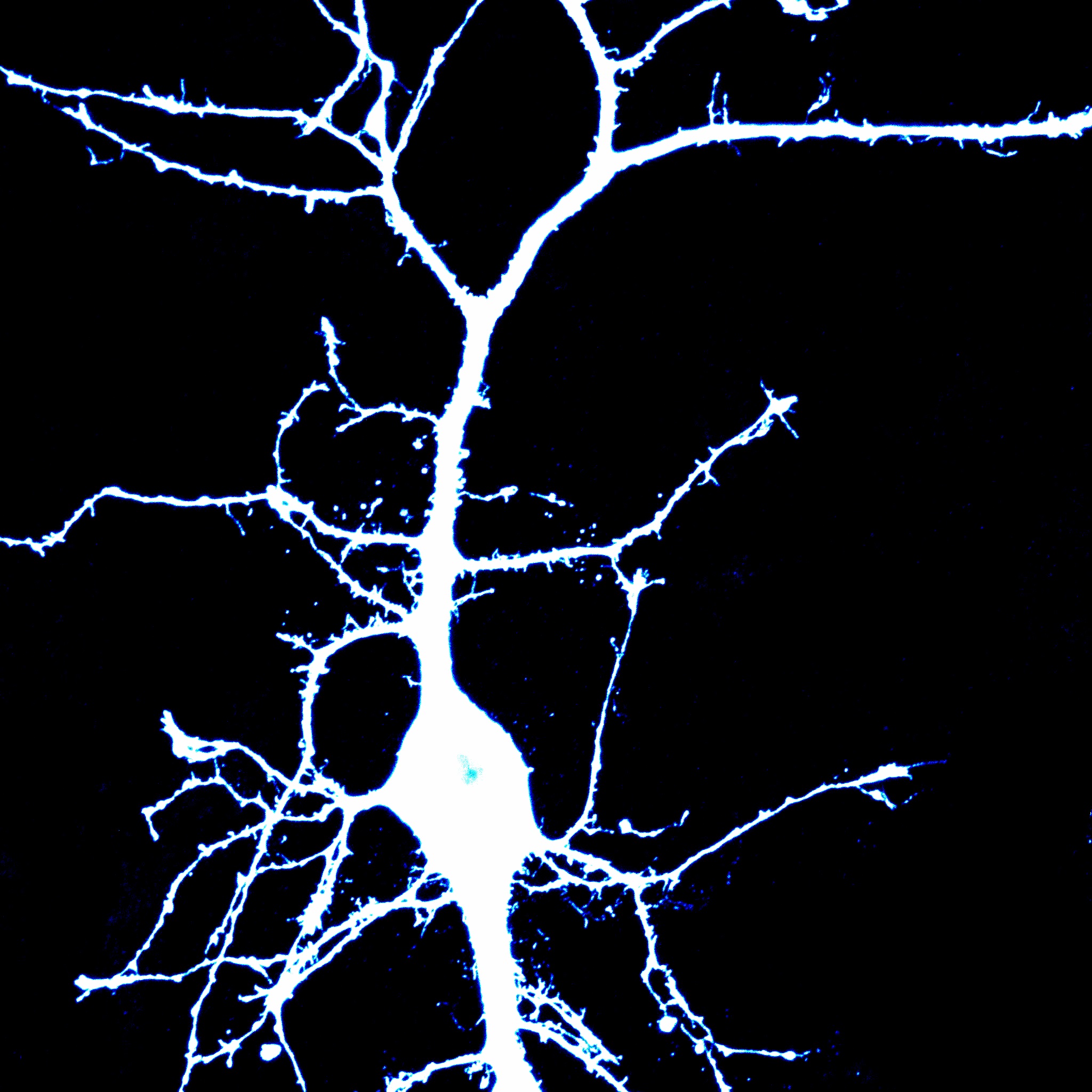 Icy a neuron